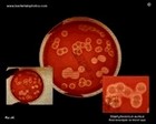 beta hemolysis